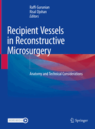 Recipient Vessels in Reconstructive Microsurgery: Anatomy and Technical Considerations