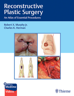 Reconstructive Plastic Surgery: An Atlas of Essential Procedures - Murphy, Robert (Editor), and Herman, Charles (Editor)