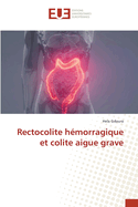 Rectocolite h?morragique et colite aigue grave