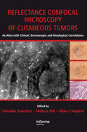 Reflectance Confocal Microscopy of Cutaneous Tumors: An Atlas with Clinical, Dermoscopic and Histological Correlations