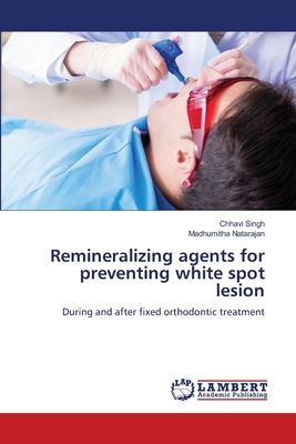 Remineralizing agents for preventing white spot lesion - Singh, Chhavi, and Natarajan, Madhumitha