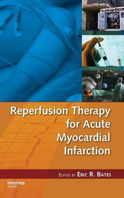 Reperfusion Therapy for Acute Myocardial Infarction - Bates, Eric R (Editor)