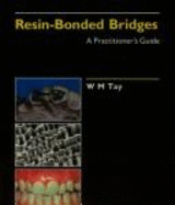 Resin-Bonded Bridges: A Practitioners Guide