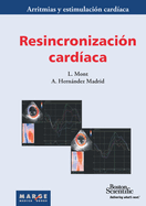 Resincronizacin cardaca