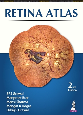 Retina Atlas - Grewal, SPS, and Brar, Manpreet, and Sharma, Mansi