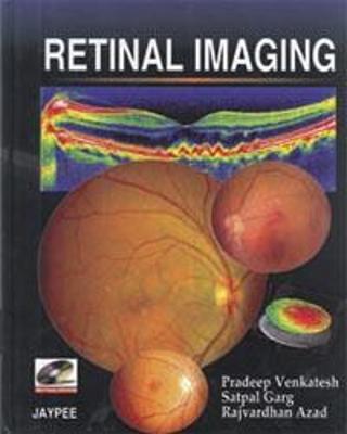 Retinal Imaging - Venkatesh, Pradeep, and Garg, Satpal, and Azad, Raj Vardhan