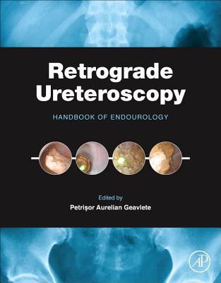 Retrograde Ureteroscopy: Handbook of Endourology - Geavlete, Petrisor Aurelian (Editor)