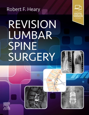 Revision Lumbar Spine Surgery - Heary, Robert F. (Editor)