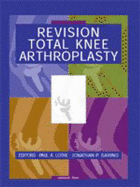 Revision Total Knee Arthroplasty - Lotke, Paul A, MD (Editor), and Garino, Jonathan P, MD (Editor), and Grino