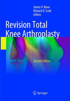 Revision Total Knee Arthroplasty - Bono, James V (Editor), and Scott, Richard D (Editor)