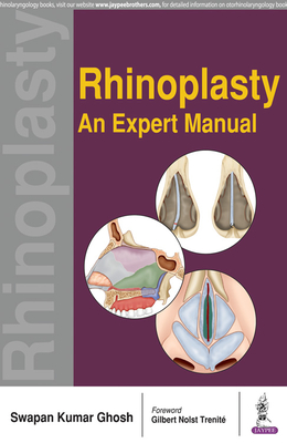 Rhinoplasty: An Expert Manual - Ghosh, Swapan Kumar