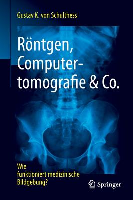 Rontgen, Computertomografie & Co.: Wie Funktioniert Medizinische Bildgebung? - von Schulthess, Gustav K.