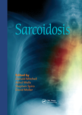 Sarcoidosis - Mitchell, Donald (Editor), and Wells, Athol (Editor), and Spiro, Stephen (Editor)