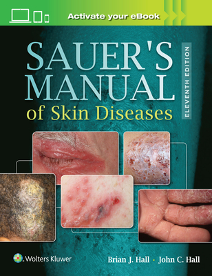Sauer's Manual of Skin Diseases - Hall, John C, Dr., and Hall, Brian J, Dr.