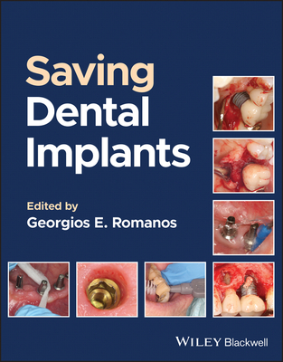 Saving Dental Implants - Romanos, Georgios E. (Editor)