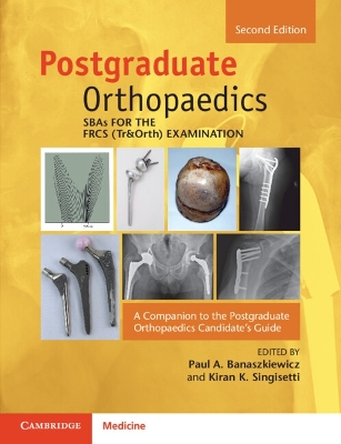 SBAs for the FRCS (Tr&Orth) Examination: A Companion to the Postgraduate Orthopaedics Candidate's Guide - Banaszkiewicz, Paul A. (Editor), and Singisetti, Kiran (Editor)