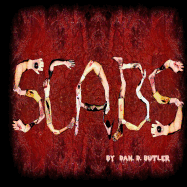 Scabs: Picking Apart the Facts