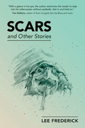 Scars: And Other Stories