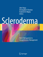 Scleroderma: From Pathogenesis to Comprehensive Management