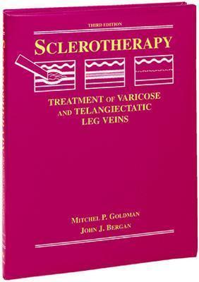 Sclerotherapy: Treatment of Varicose and Telangiectatic Leg Veins - Goldman, Mitchel P, MD, and Bergan, John J, Hon., MD, Facs