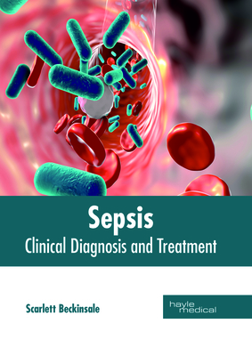 Sepsis: Clinical Diagnosis and Treatment - Beckinsale, Scarlett (Editor)