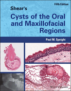 Shear's Cysts of the Oral and Maxillofacial Regions