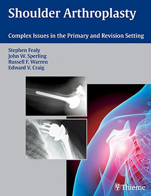 Shoulder Arthroplasty: Complex Issues in the Primary and Revision Setting - Fealy, Stephen (Editor), and Sperling, John W (Editor), and Warren, Russell F (Editor)