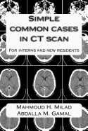 Simple common cases in CT scan: For interns and new residents