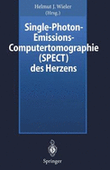 Single-Photon-Emissions-Computertomographie (Spect) Des Herzens