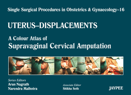 Single Surgical Procedures in Obstetrics and Gynaecology - Volume 16 - Uterus - Displacements: A Colour Atlas of Supravaginal Cervical Amputation (Nadkarni's)