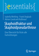 Skaphoidfraktur und Skaphoidpseudarthrose: Eine ?bersicht f?r ?rzte aller Fachrichtungen