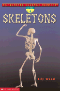 Skeletons (Level 2)