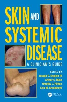 Skin and Systemic Disease: A Clinician's Guide - English III, Joseph C, and Huen, Arthur C, and Patton, Timothy J