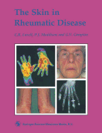 Skin in Rheumatic Disease