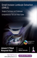 Small Incision Lenticule Extraction (SMILE): Surgical Technique and Challenges: Comprehensive Text and Video Guide