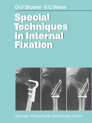 Special Techniques in Internal Fixation - Brunner, C. F., and Telger, T. C. (Translated by), and Weber, B. G.