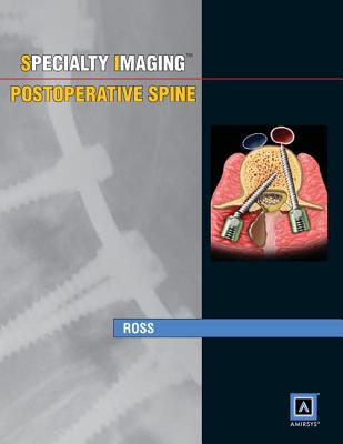 Specialty Imaging: Postoperative Spine: Published by Amirsys - Ross, Jeffrey S, MD