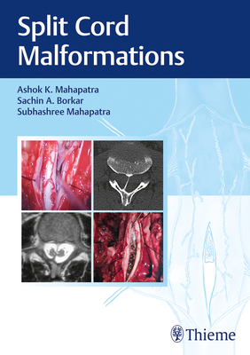 Split Cord Malformations - Mahapatra, Ashok, and Borkar, Sachin, and Mahapatra, Subhashree