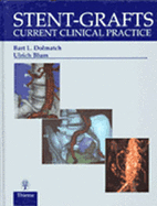 Stent-grafts: Current Clinical Practice