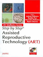 Step by Step: Assisted Reproductive Technology (ART)