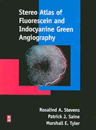 Stereo Atlas of Fluorescein and Indocyanine Green Angiography - Saine, Patrick J, Med, and Stevens, Rosalind A, MD, and Tyler, Marshall E