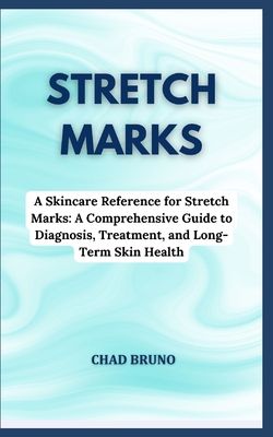 Stretch Marks: A Skincare Reference for Stretch Marks: A Comprehensive Guide to Diagnosis, Treatment, and Long-Term Skin Health - Bruno, Chad
