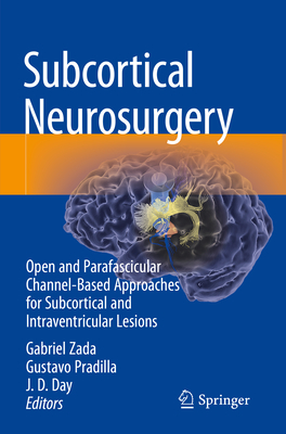 Subcortical Neurosurgery: Open and Parafascicular Channel-Based Approaches for Subcortical and Intraventricular Lesions - Zada, Gabriel (Editor), and Pradilla, Gustavo (Editor), and Day, J. D. (Editor)