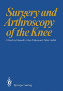 Surgery and Arthroscopy of the Knee: First European Congress of Knee Surgery and Arthroscopy Berlin, 9-14. 4. 1984