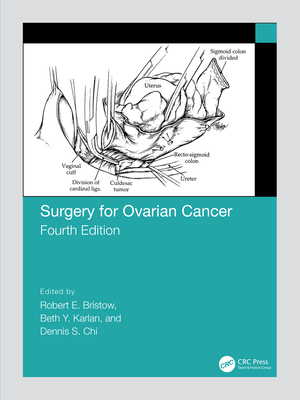 Surgery for Ovarian Cancer - Bristow, Robert (Editor), and Karlan, Beth (Editor), and Chi, Dennis (Editor)