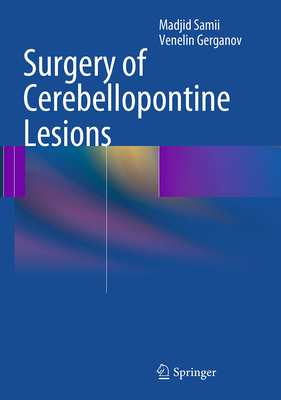 Surgery of Cerebellopontine Lesions - Samii, Madjid, and Gerganov, Venelin