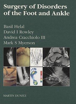 Surgery of Disorders of the Foot and Ankle - Cracchiolo, Andrea C, and Helal, Basil M, and Myerson, Mark M