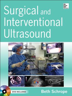 Surgical and Interventional Ultrasound - Schrope, Beth