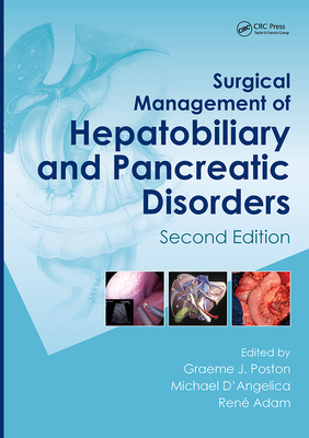 Surgical Management of Hepatobiliary and Pancreatic Disorders - Poston, Graeme J (Editor), and D'Angelica, Michael (Editor), and Adam, Ren (Editor)