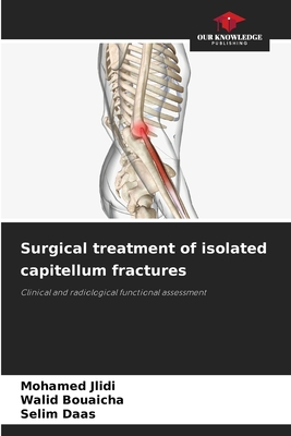 Surgical treatment of isolated capitellum fractures - Jlidi, Mohamed, and Bouaicha, Walid, and Daas, Selim